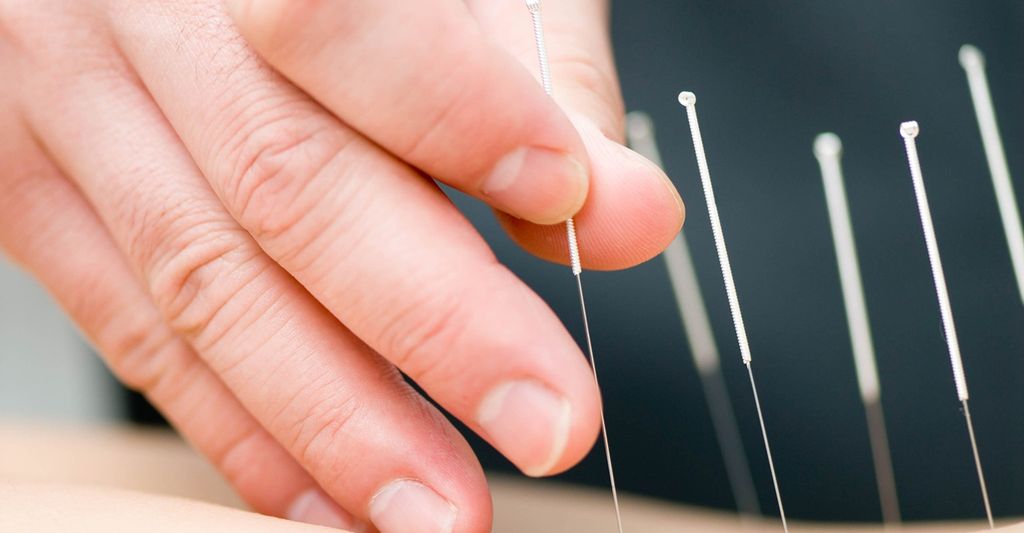 Find an Acupuncturist near you