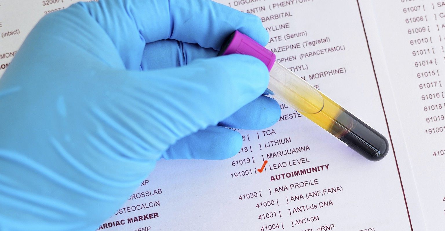 The 10 Best Lead Testing Companies in San Diego, CA 2023