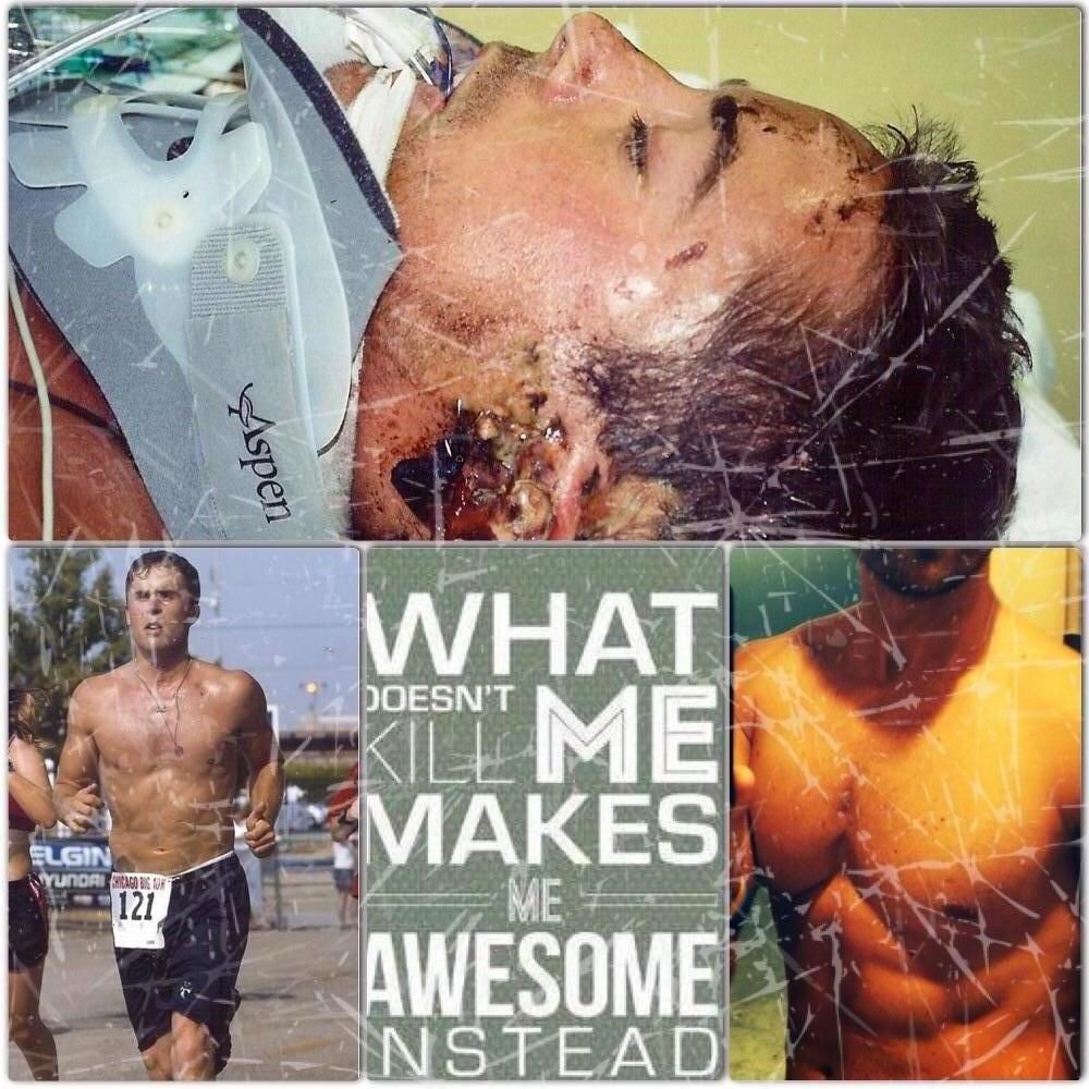 Years after being in an accident his hard work & t