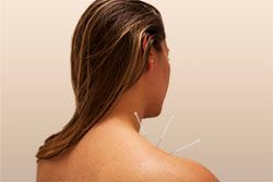 Acupuncture- principle that specific points on the