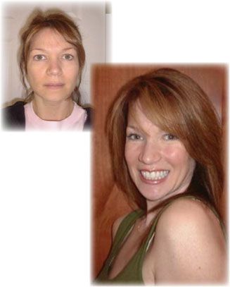 Before and after of 39 year old woman.