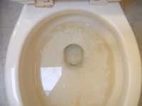 Toilet Before Cleaning