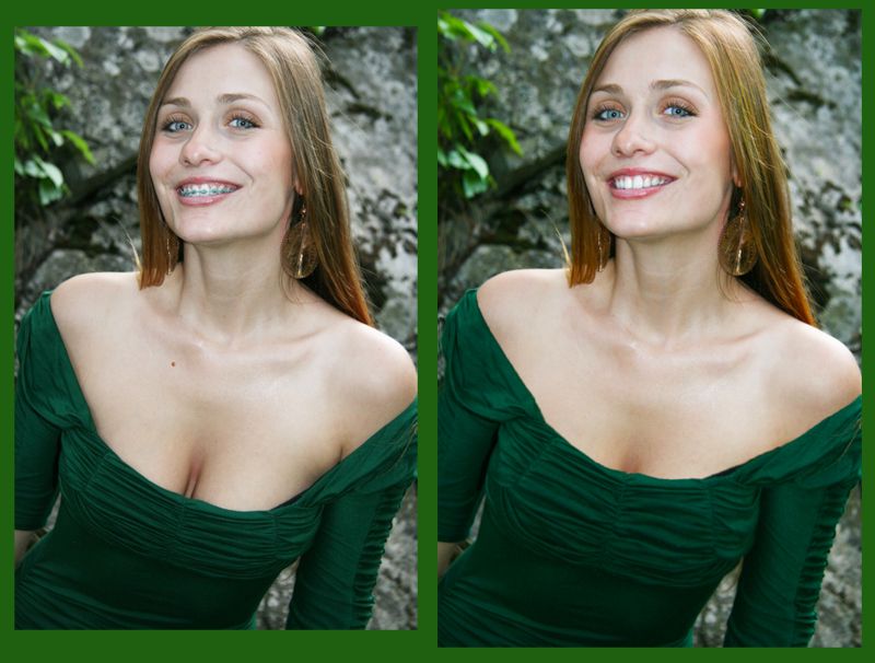 Here is an example of my photo retouching. I remov