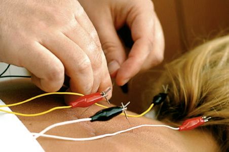 Electrical stimulation: painful joints, muscle inj