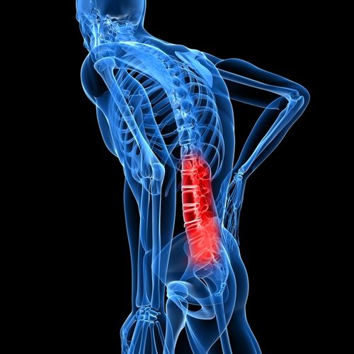 There are certain behaviors that create back pain.