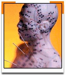 Little Needles Community Acupuncture