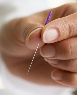 Acupuncture needles are as thin as your hair and v