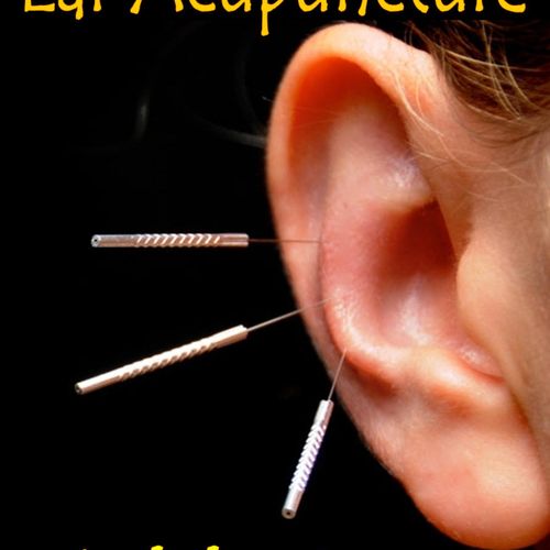 Ear Acupuncture: 
Emotional problems such as Anxie