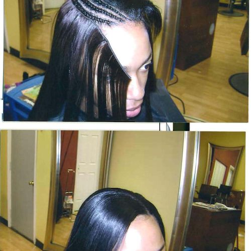Before and After example of a sew in