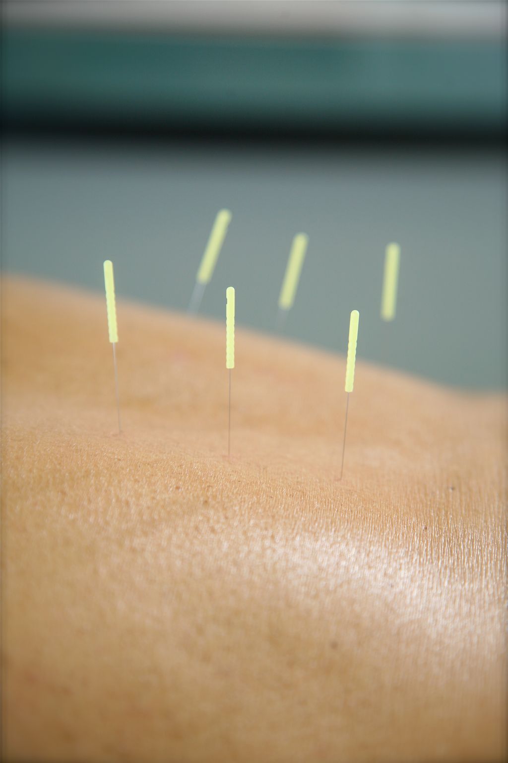 local treatment for low back pain