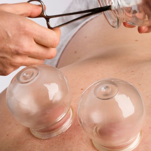 Cupping: muscle tightness, Myofascial Release, str