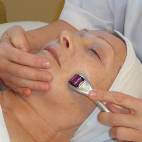 Micro-needling Therapy