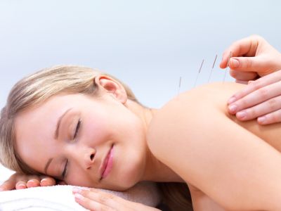 Acupuncture Therapy is available every Monday & Th