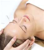An Acupuncture Approach