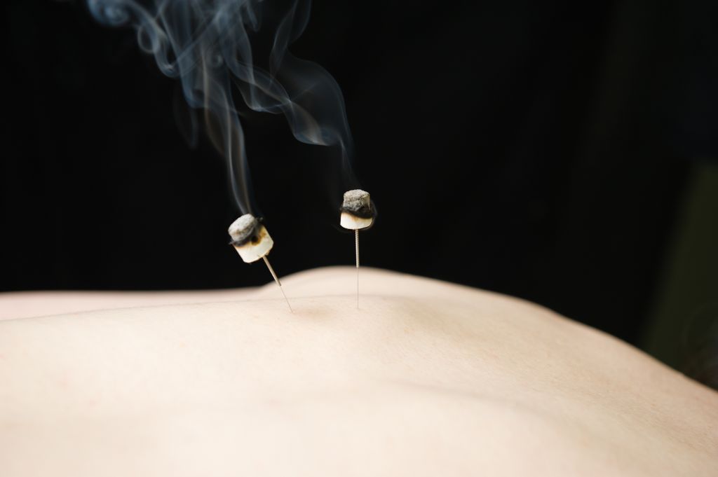 This is moxa: it warms the areas on the body and h