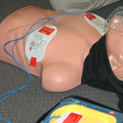 AED attached to patient.......ready to shock
