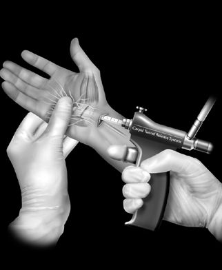 Medical Device