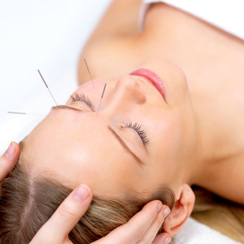 Cosmetic Acupuncture helps with facial toning and 