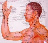 Physicians' Choice Acupuncture