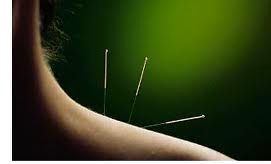 Acupuncture; graceful tool with a profound effect