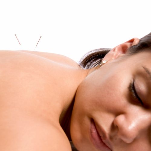 Relax with a private acupuncture or massage sessio