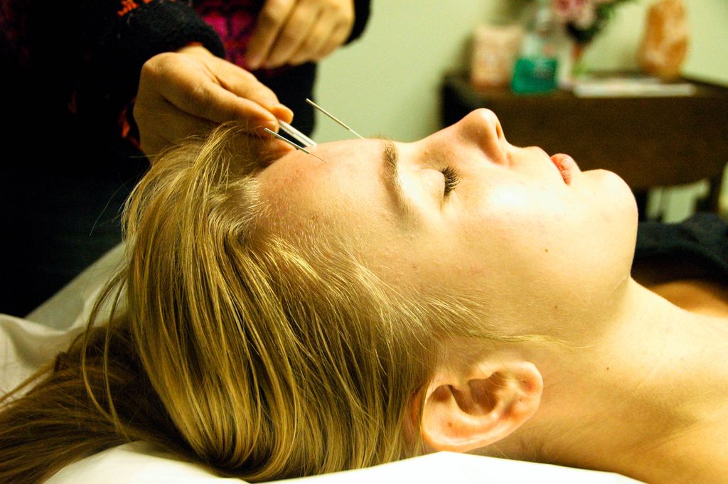Calming effect with acupuncture