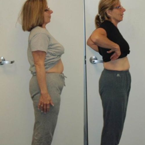 Here's Carolyn, a 62-year old woman after 10 weeks