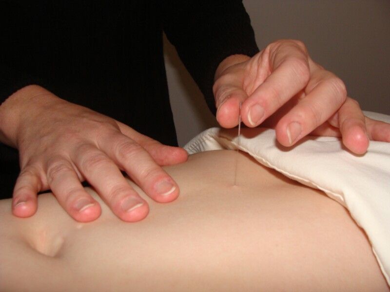 Acupuncture needling close-up
