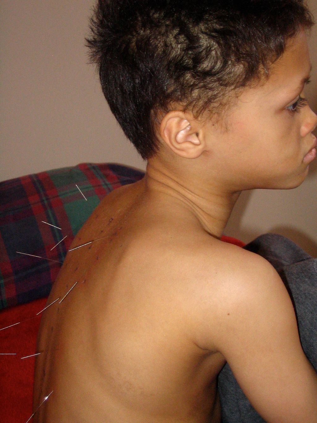 One of our clients while being treated