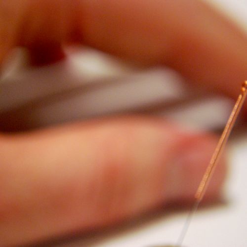 Acupuncture needles are extremely thin and delicat