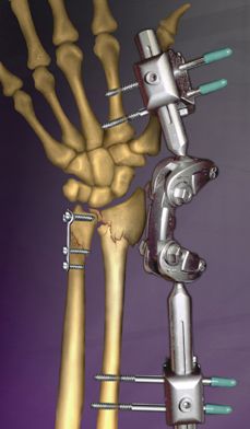 Medical illustration / surgery