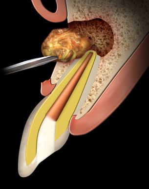 Dental