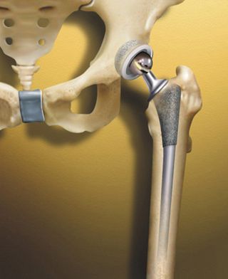 Surgery, medical illustration