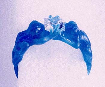 Frog ring