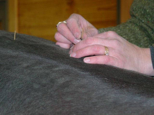 Placing an acupuncture needle.
