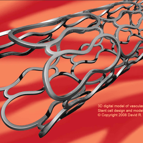 Vascular stent (created as a 3D digital model that can be rotated and animated)