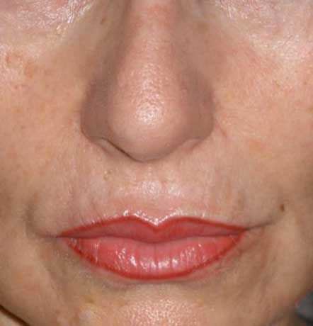 Permanent Makeup For the Lips In Encino