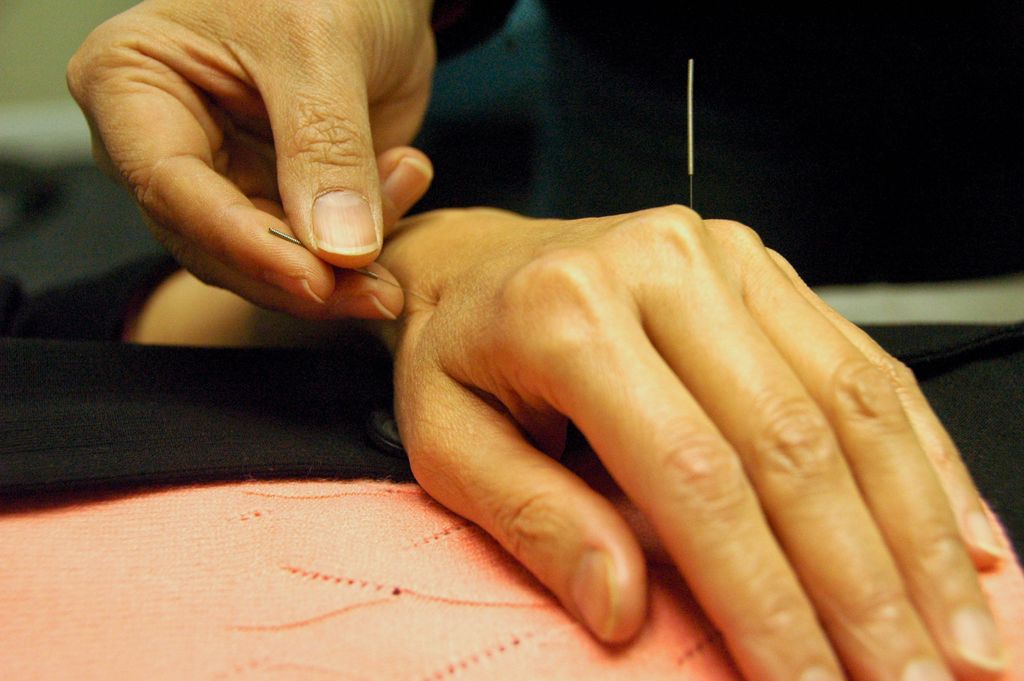 Acupuncture treatment