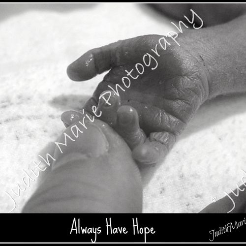 First Hour of Life.  Micro preemie was not expecte