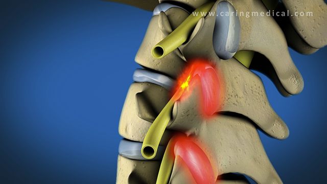 Medical Illustration