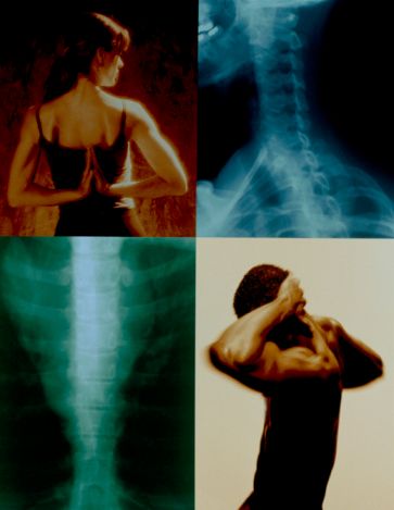 Your X-Rays reveal how your bone structure is out 