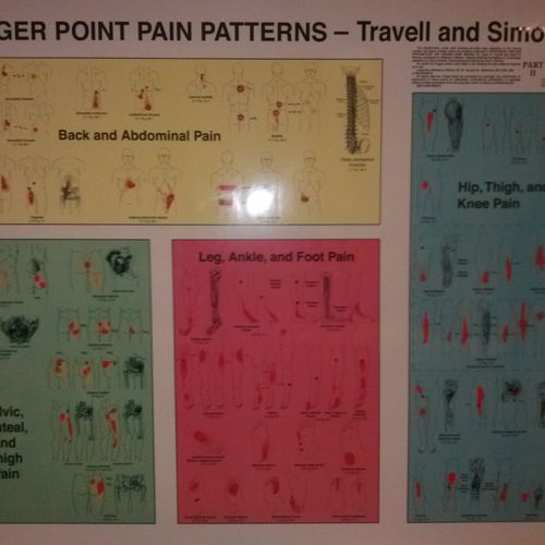 Pt 2 Trigger Point pain pattern by Simon ant Trave