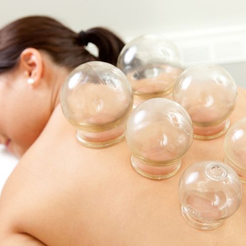 Cupping is used for pain management as well as for