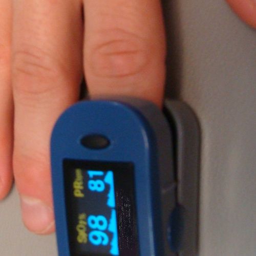 Monitoring patients pulse and oxygen saturation wh