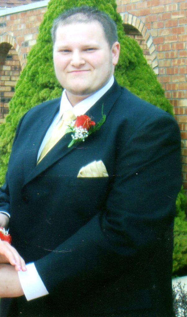 Philip B Before losing 134 pounds