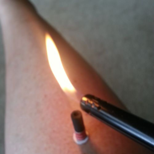 Burning moxa on my leg to boost energy and to warm