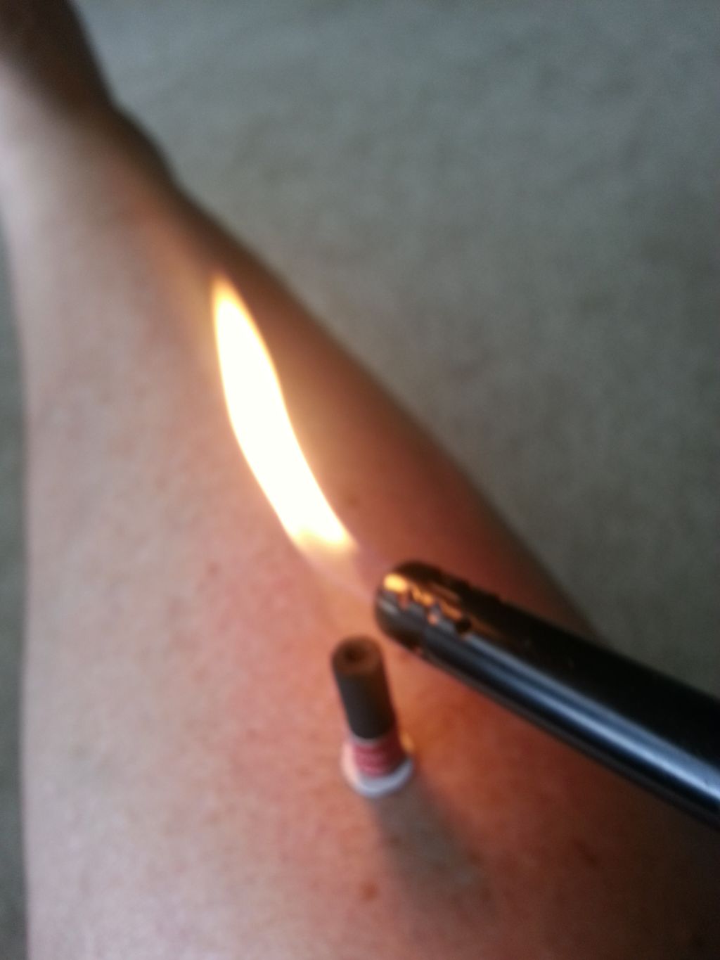 Burning moxa on my leg to boost energy and to warm