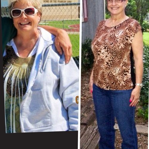 With NO exercise routine, Doris lost 35 lbs throug
