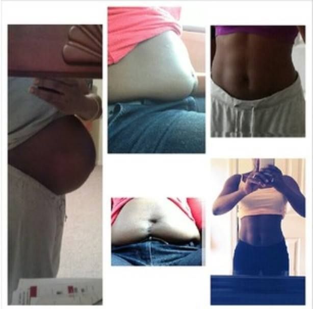 Pregnancy, post pregnancy (c-section and abdominal