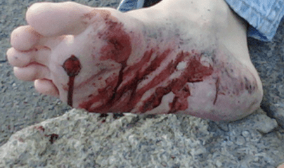 Moulage Makeup to simulate whipped feet